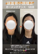 ジャスミン(Jasmine)/頭蓋骨小顔矯正