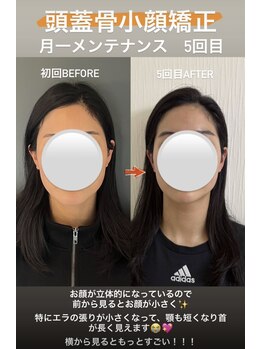 ジャスミン(Jasmine)/頭蓋骨小顔矯正