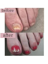 ティアラネイル 宇都宮/