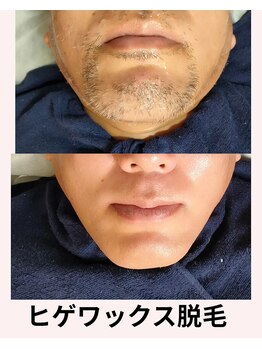 ビー ファクトリー(B FACTORY)/ひげワックス