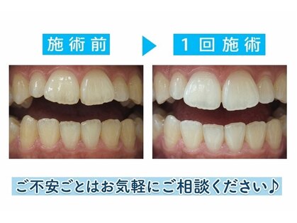ヴィヴィ(ViVi)の写真