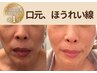 【口元・ほうれい線に】たるみ改善×リフトUPマシン×首肩スッキリ×ヘッド付