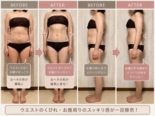 メデル(MEDEL)の雰囲気（土台から整えてバストも身体も変わる♪一生モノのバストケア）