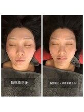 プライミー(PRIMY)/面長改善