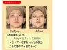 透明美肌人気No1【シミケア・くすみ・毛穴・ハリ】E-Light光フォトで美肌に♪