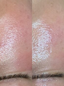 グリーン(green)/赤み、ありませんか?