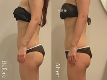 ユーフォリア グロウ(euphoria glow)/｛　ラフォス痩身90分 4回　}