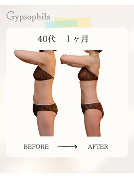 ジプソフィラ(Gypsophila)/痩身ビフォーアフター