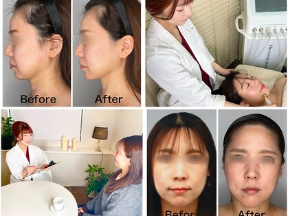 ケイ(Kei)の写真