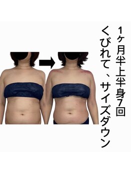 スピード美人 新宿店/スライドカッピング上半身7回