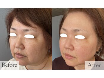 楚々(SOSO)の写真/その日だけじゃない♪ 持続する高級フェイシャル肌質改善【契約・勧誘・販売なし】