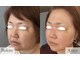楚々(SOSO)の写真/その日だけじゃない♪ 持続する高級フェイシャル肌質改善【契約・勧誘・販売なし】