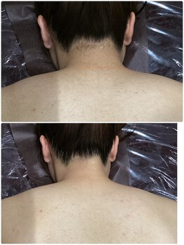 アンジュヴィバラヴィーダ(Ange viva la vida)/★ビフォーアフター★