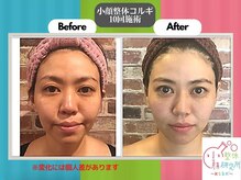 小顔整体研究所 KSラボ 麻布十番店の雰囲気（お客様から伝えなくても伝わる魔法のカルテでリピート率90％以上）