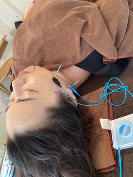 ハリファ鍼灸院 横浜関内院(HariFa鍼灸院)/美容施術