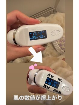 ジャドール ネイルアンドアイラッシュ(J'ADORE)/ハーブピーリング