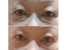 トウゲンキョウの雰囲気（目元のたるみにも幹細胞フェイシャル☆）