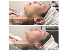 リアン(Re.庵)の雰囲気（美容鍼/小顔筋艶肌フェイシャル◎違いがわかるフェイシャル！）