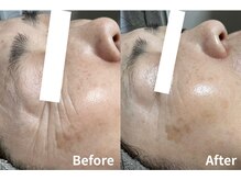 エルア 尼崎(Elua)/