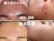 ミハン ボーテ(mihan.beaute)の写真