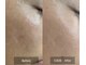 サロン ド アヤ(salon de Aya)の写真/毛穴開き・黒ずみ，シミ・くすみ，ニキビでお悩みの方へ◎根本から肌を整え，肌質改善に特化♪