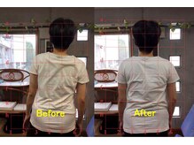 アトラス ストレートカイロプラクティック/腰痛や体の歪み