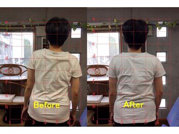 アトラス ストレートカイロプラクティック/腰痛や体の歪み