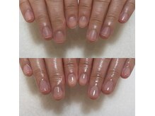 エマネイル(emma nail)/ケア後はうるつやの手元に！
