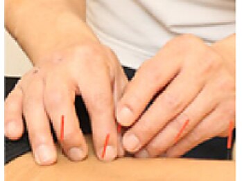 ユミーの写真/【首/肩こり/腰痛/背中が気になる方オススメ★】以外に足や膝に原因が!?根本改善をお考えの方へ、、