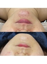 シエル 美里店(ciel)/陶肌トリートメント