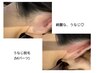 魅せるうなじを手にいれよう◇気になる脱毛パーツNo1うなじ脱毛体験¥4400→