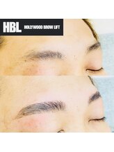 プルメリア(Plumeria)/