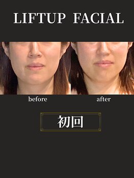 ノーブルノアール(Noble noir)/輪郭しゅっと小顔☆