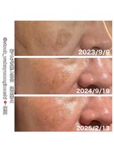 ルミヌーズ(Lumineuse)/内側からシミ.毛穴ケア