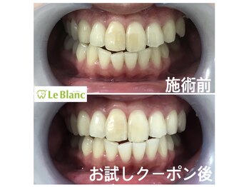 ルブラン 奈良店(Le Blanc)/目に見える着色汚れ