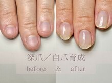 ル リアン 北浦和(le lien)/深爪育成(6ヶ月／8回)