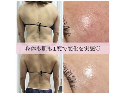 アスピリア(aspirer a')の写真