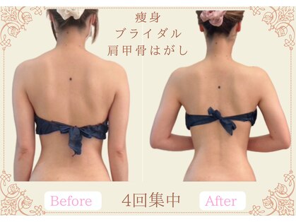 ヴェルセーヌ(VelleSaine)の写真
