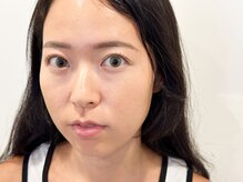 トミー(Tommy)/まつげパーマ