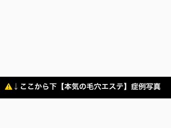 ラボキュー(LABO-9)/