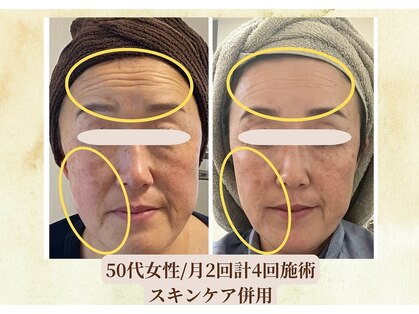 サロン カズリナ(Salon Kazrina)の写真
