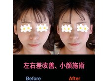 美容矯正サロン レレポノ(LELEPONO)/