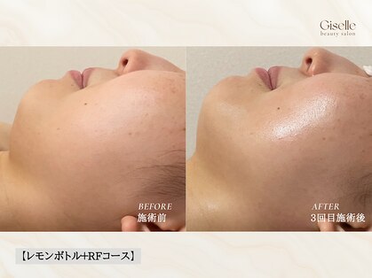 ジゼル(Giselle)の写真