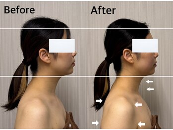 ベール(BEHL)/コルギのBefore After