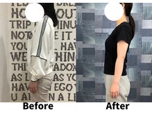 リセラ(Re:seraph)/Before After