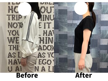 リセラ(Re:seraph)/Before After