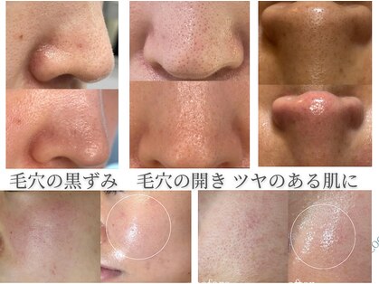 ココリールの写真