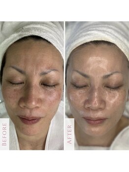 オーリス(Aurise)の写真/「もう年齢だから」で終わらせない、大人のための韓国艶肌管理。