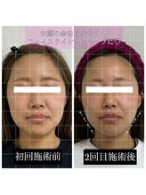 ファミーユ(famille)/小顔頭蓋骨骨盤矯正 B/A