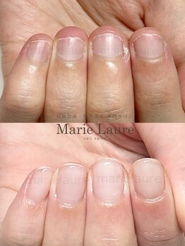 マリーロール 天王寺店(Marie Laure)/深爪矯正/自爪育成/ネイルケア/